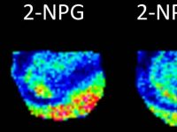 A Nanoparticle Co-matrix for Multiple Charging in MALDI Imaging of Tissue