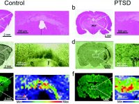 Label-free lipidome study of PVT of rat brain with post-traumatic stress injury by Raman imaging